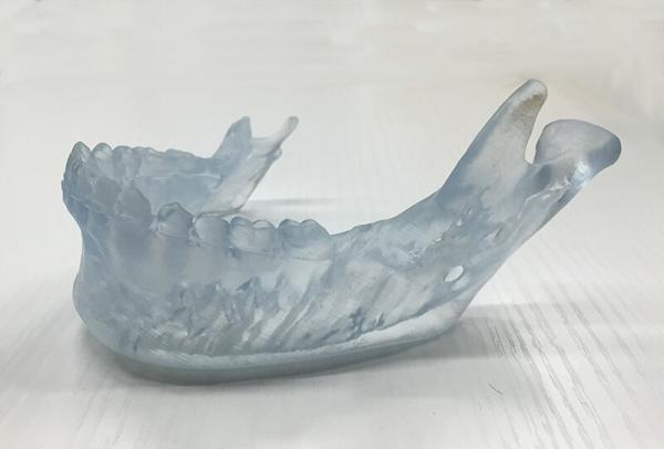 치과 치아 부분